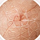 Irritated sensitive skin